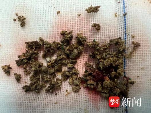 新澳门资料大全正版资料2024年免费丨早秋从“肠”计议：肠健康才能常健康  第1张